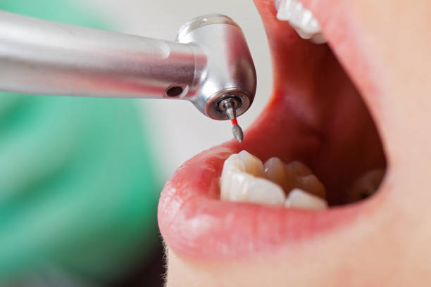 Best Emergency Dental Care for Broken or Chipped Teeth in Palm River Clair Mel, FL